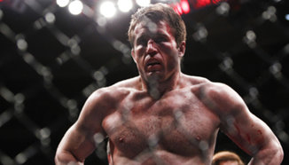 Екипът на Sonnen умира от страх в TUF Brazil 3