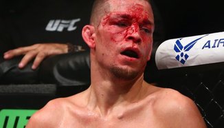 Dana White: Dos Anjos трябваше да бъде арестуван в опит за убийство на Diaz