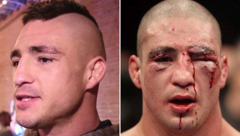 UFC бойците - снимки преди и след