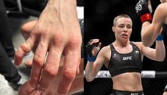 Роуз Намаюунас със счупване на ръката от UFC Paris