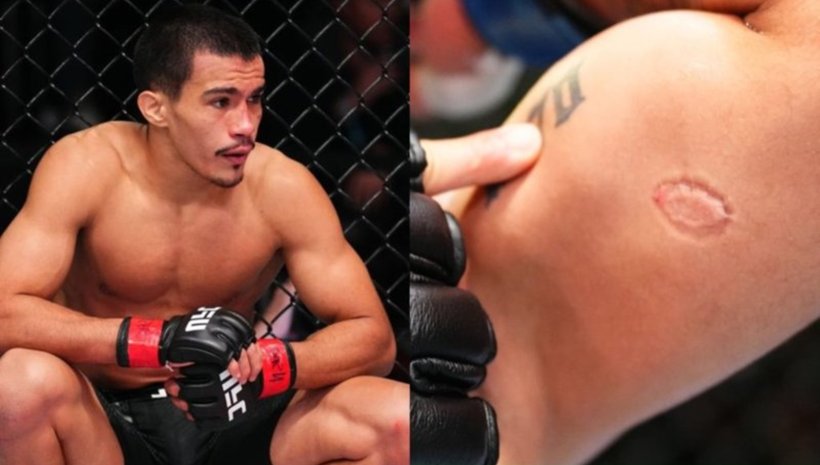 Игор Северино наказан за девет месеца заради ухапване на опонент в UFC