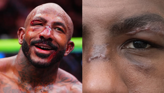 Халил Раунтри показва ужасяващи белези след битката с Алекс Перейра