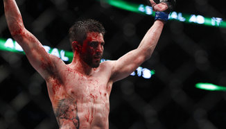 Carlos Condit е готов да се бие отново с Rory MacDonald